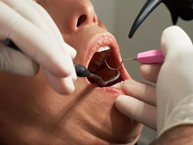 Park Dental Partners (PARK) strebt den Börsengang an der Nasdaq an. Die zahnarztgeführte Organisation unterstützt mehr als 200 Zahnärzte in Minnesota und Wisconsin über langfristige Serviceverträge.