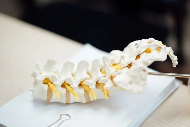 Anatomisches Wirbelsäulenmodell auf einem Tisch als Bezug zum Börsengang von Carlsmed und dessen KI-gestützten Implantaten für die Wirbelsäulenchirurgie